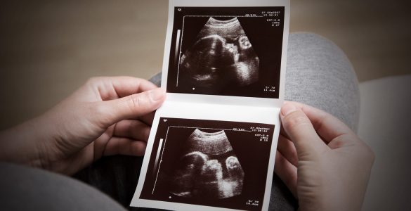 The Miscarried Fetus in Islam: Meeting Your Lost Child in Jannah